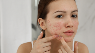 Five Skin Problems Caused by Chemical-Based Body Washes and What to Use Instead