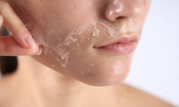 Dry Skin vs Dehydrated Skin