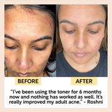 UpCircle Travel Toner